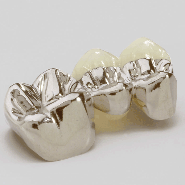 Jensen INTEGRITY Dental Noble White Alloy